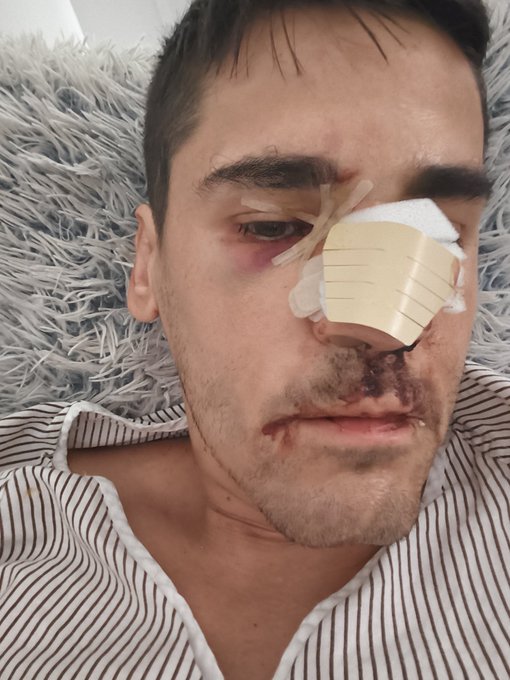 El fascismo anda suelto y con rabia: agreden al escritor y periodista Fonsi Loaiza en&nbsp;Cádiz